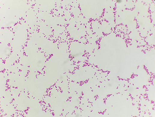 阴沟肠杆菌革兰氏染色图片
